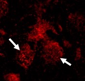 Elevation of RIP3 in nuclei of neurons from neuronopathic Gaucher (red; arrows) disease mice